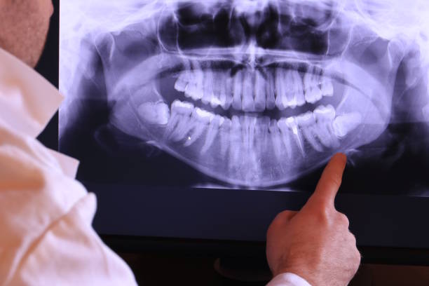 Best Urgent Care for Lost Fillings or Crowns in Napili Honokowai, HI