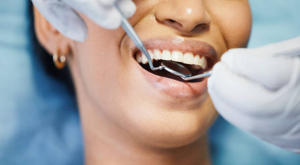 Best Emergency Gum Treatment in Napili Honokowai, HI